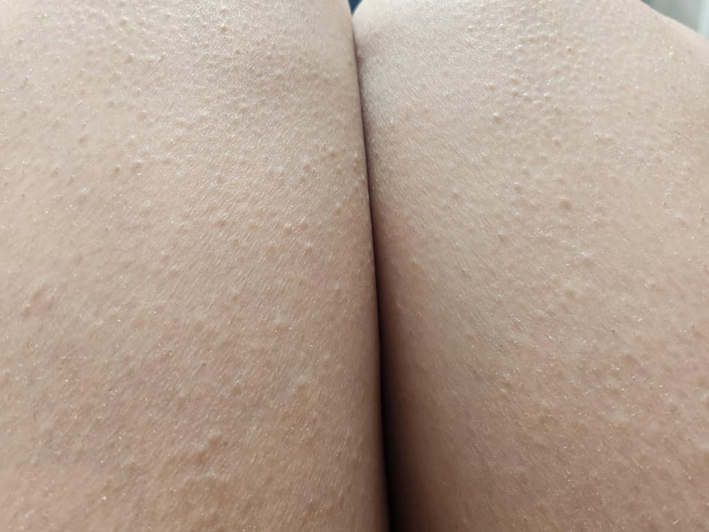 3번 째 사진