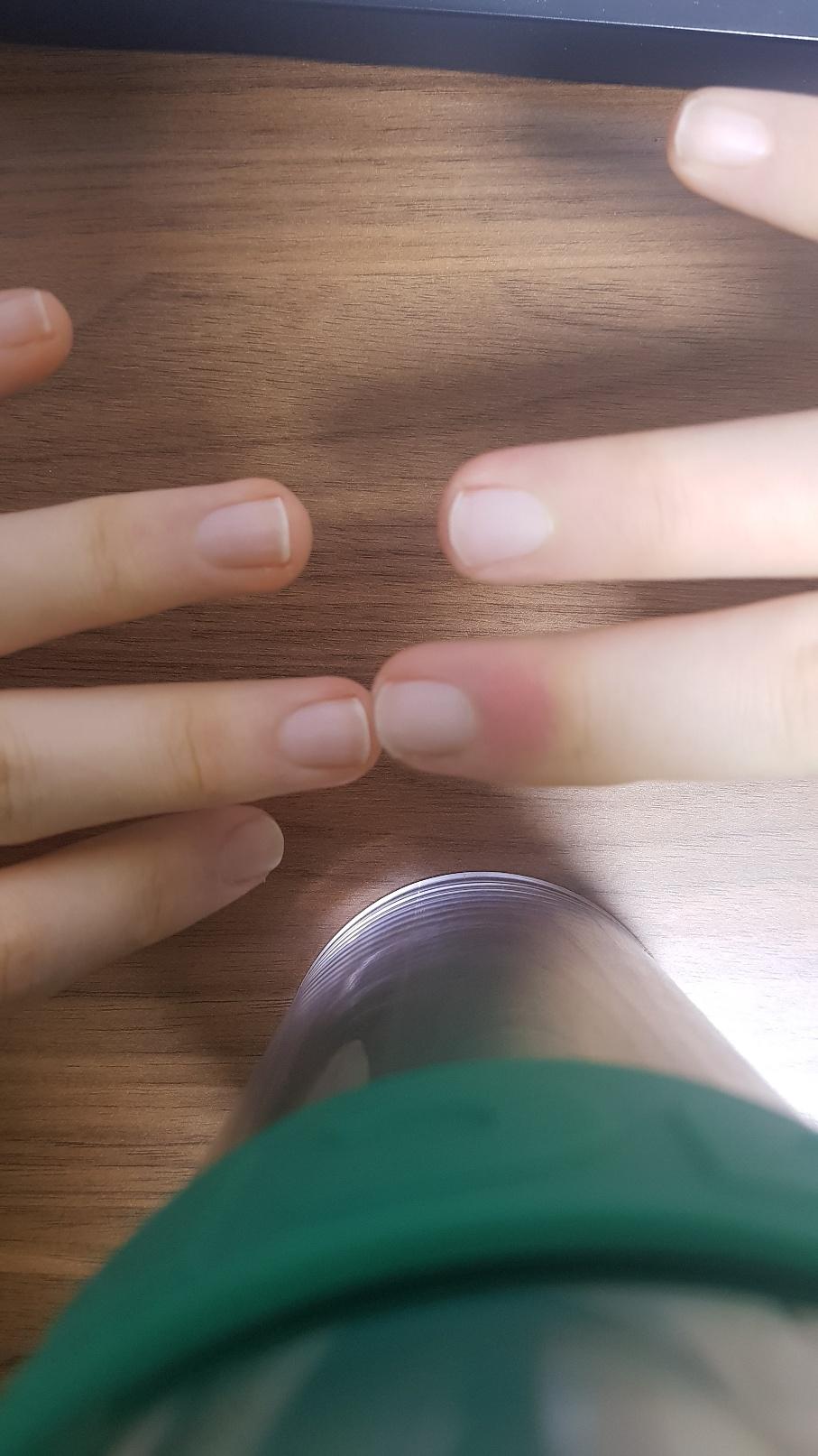 2번 째 사진