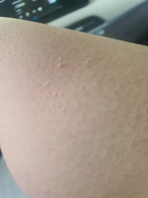 2번 째 사진