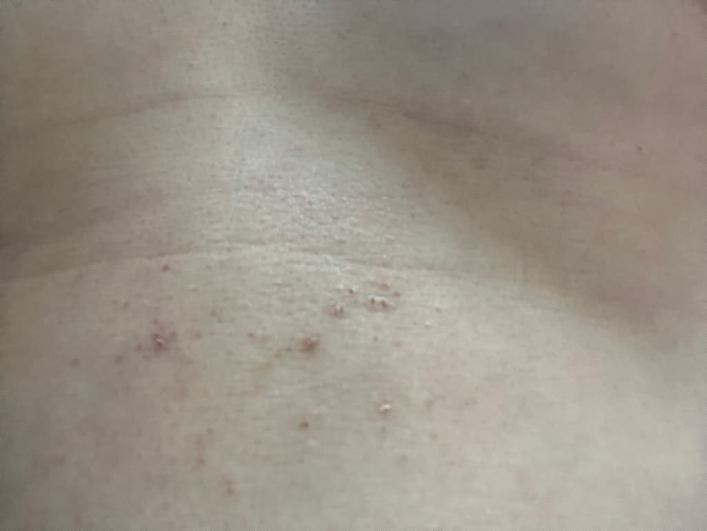9번 째 사진