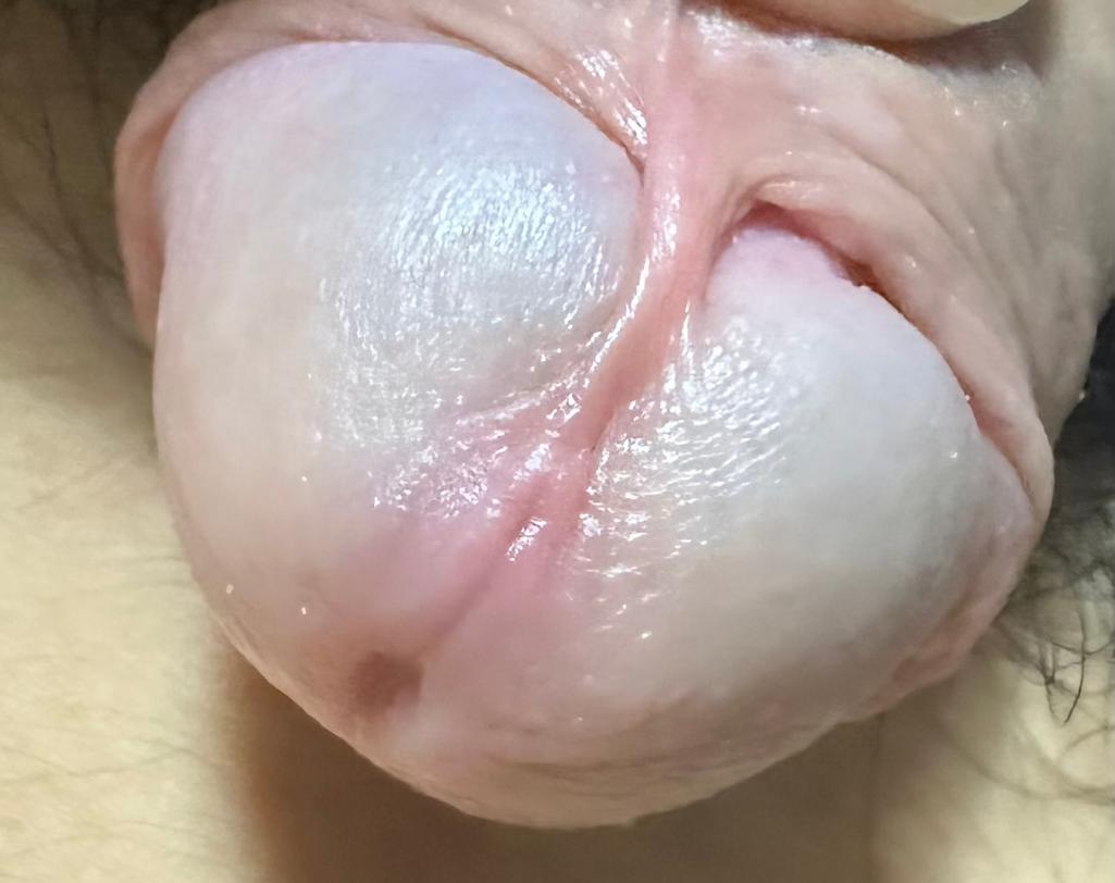 2번 째 사진