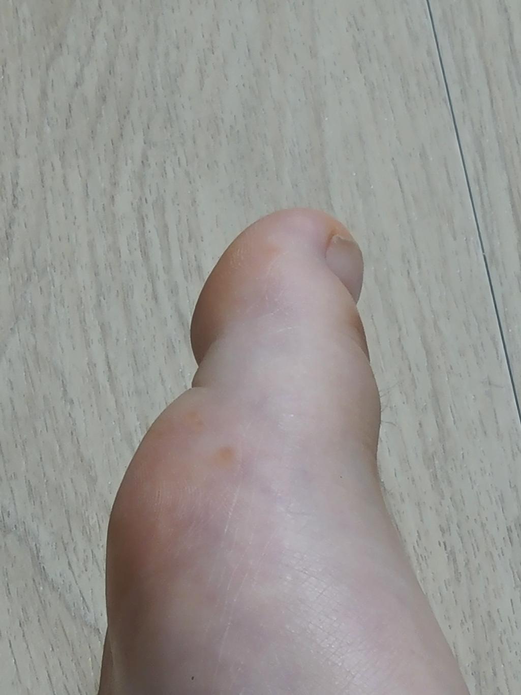 2번 째 사진