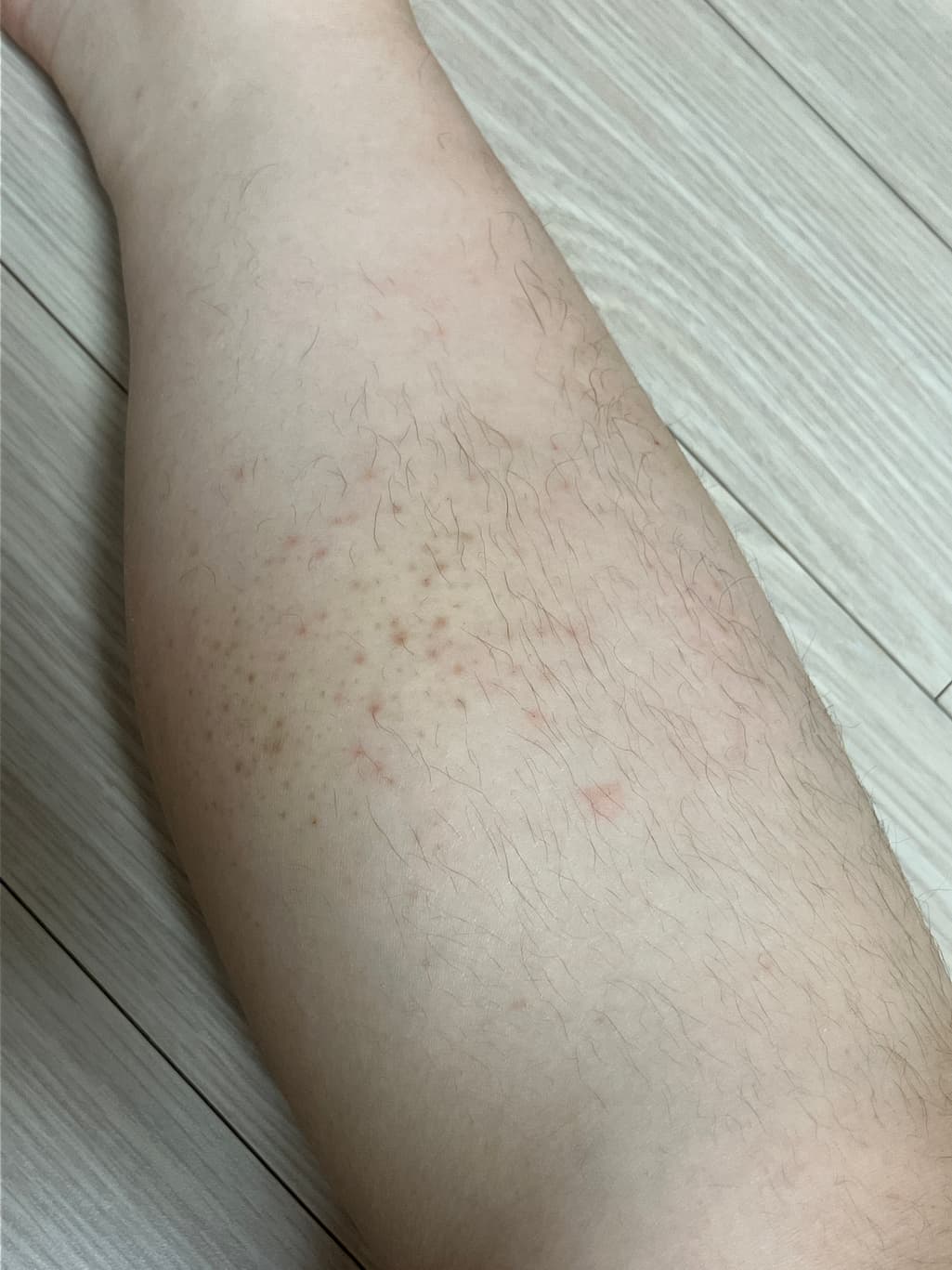 2번 째 사진
