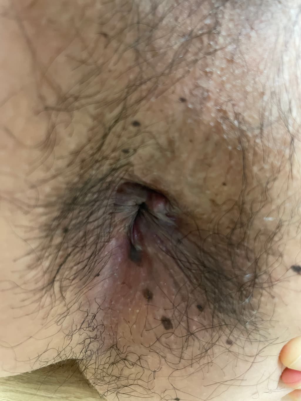 2번 째 사진