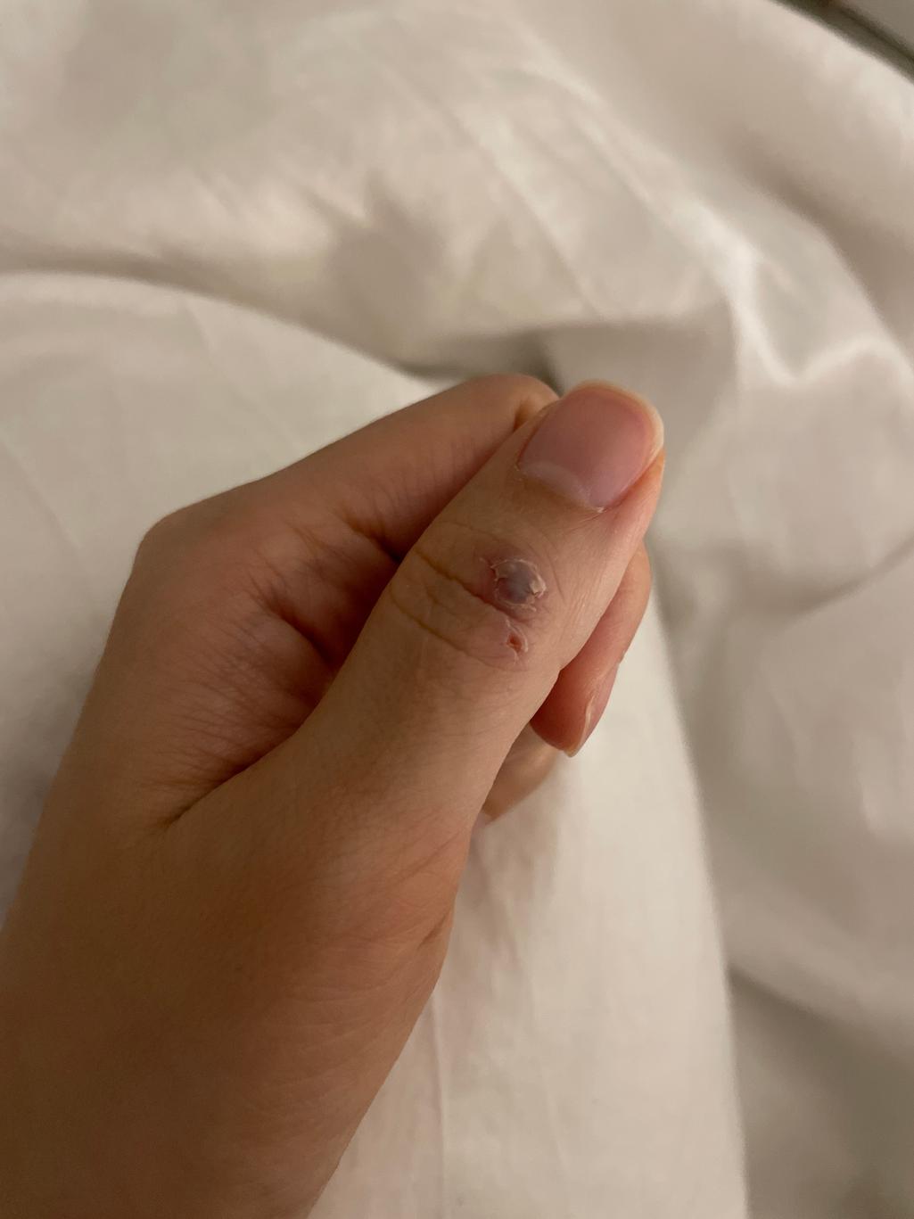 1번 째 사진