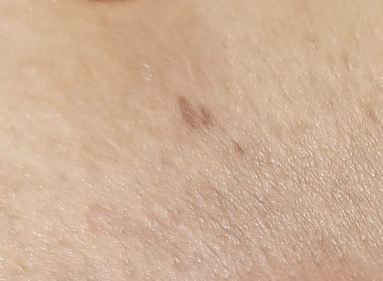 2번 째 사진