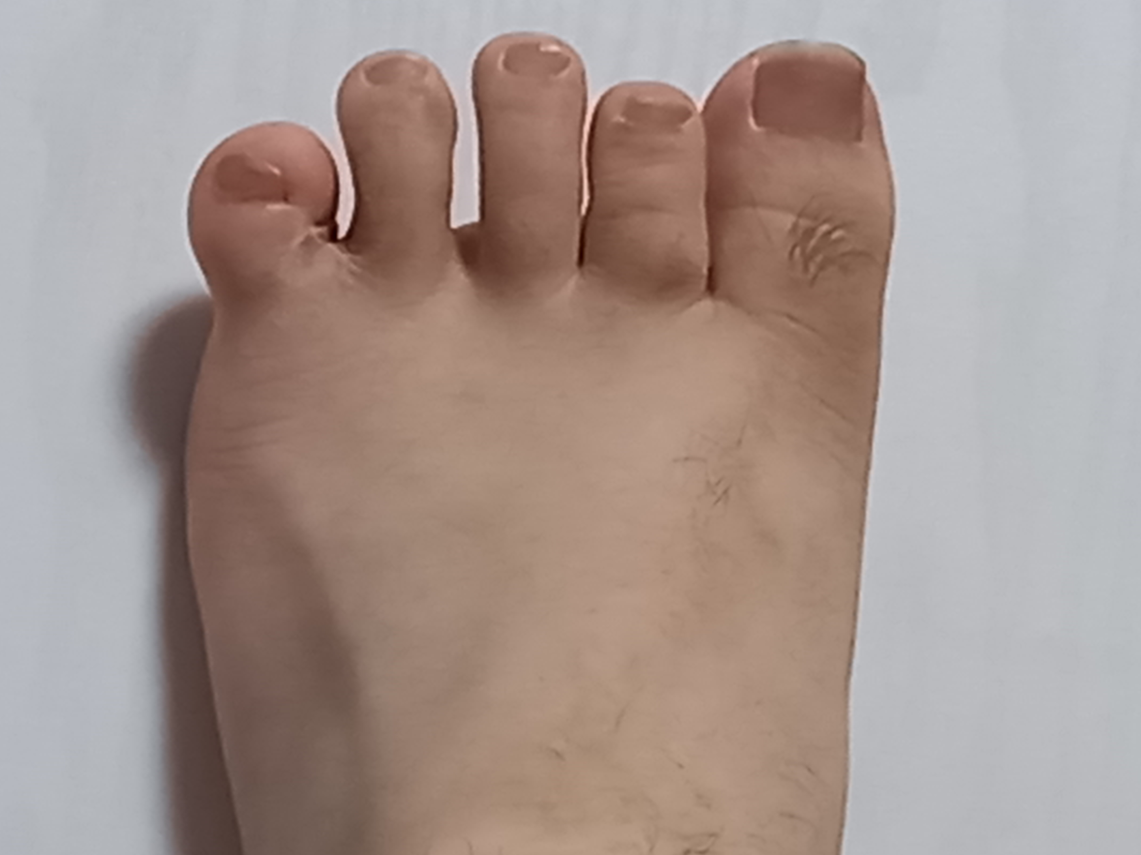 2번 째 사진