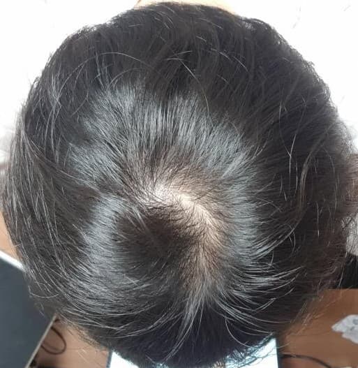 9번 째 사진