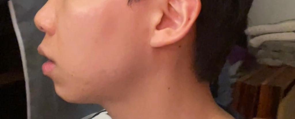 2번 째 사진