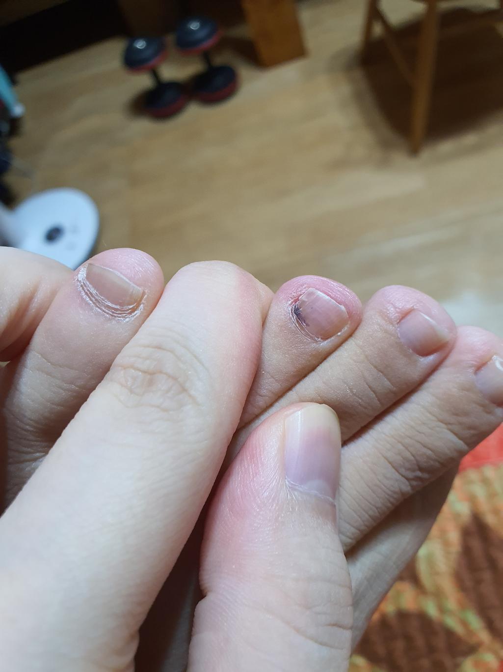 1번 째 사진
