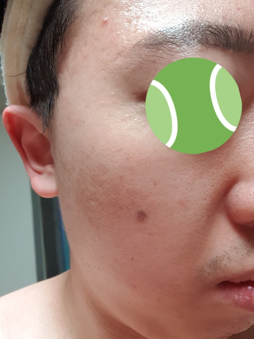 3번 째 사진