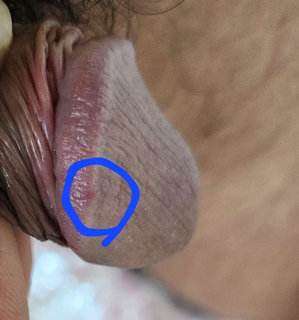 2번 째 사진