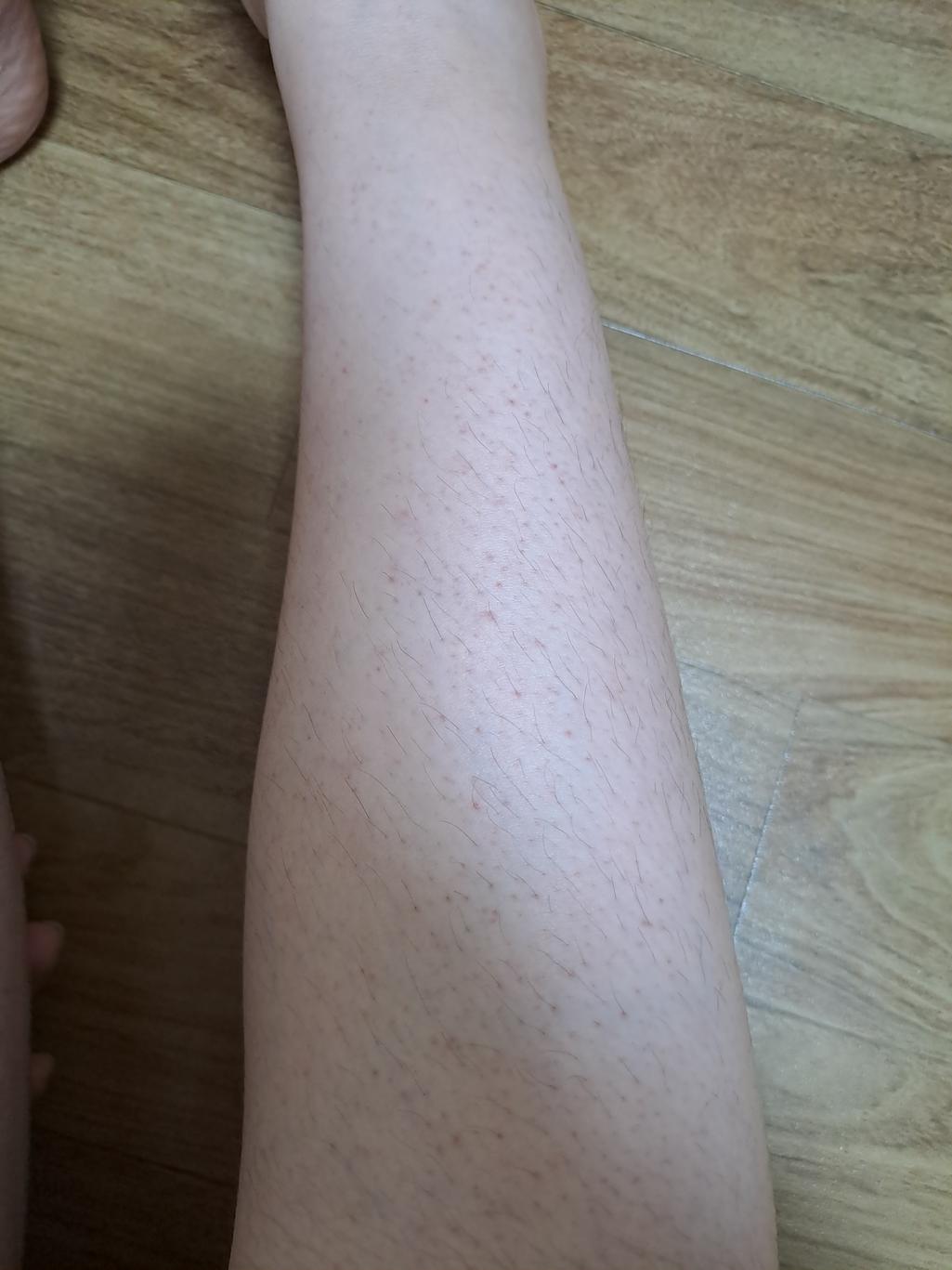 2번 째 사진