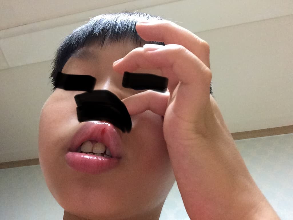 2번 째 사진