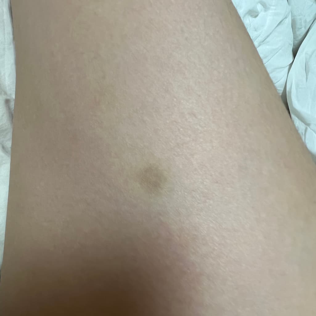 2번 째 사진