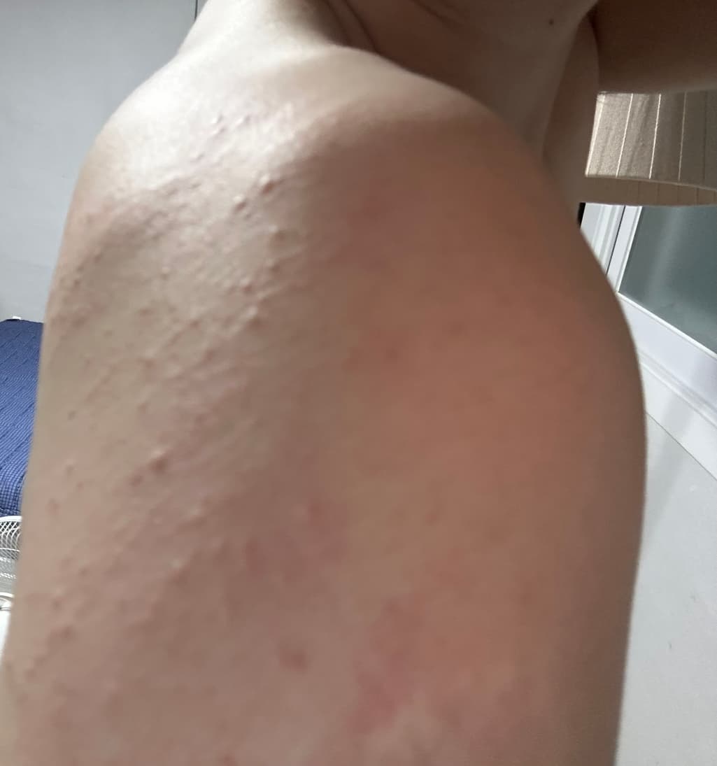 2번 째 사진