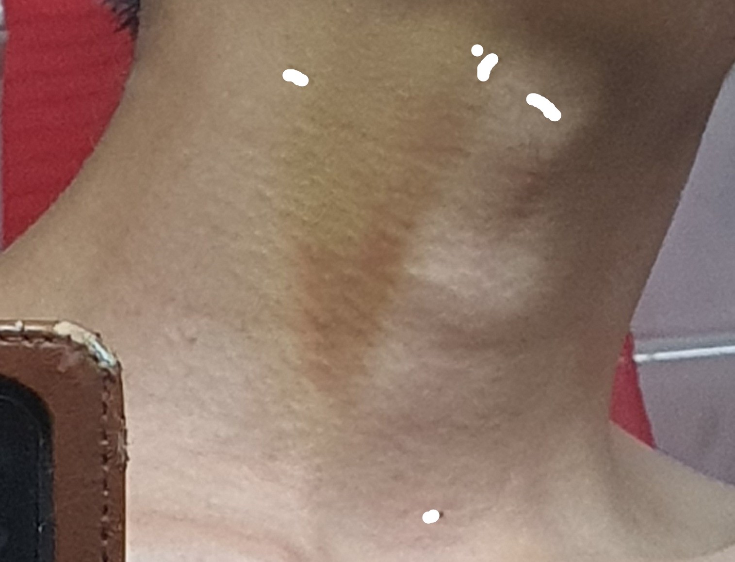 2번 째 사진