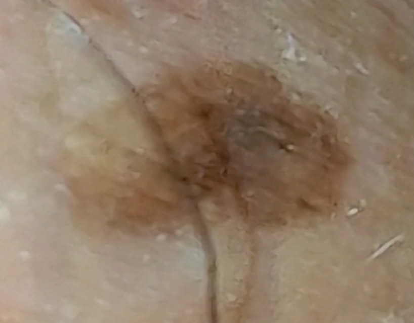 3번 째 사진