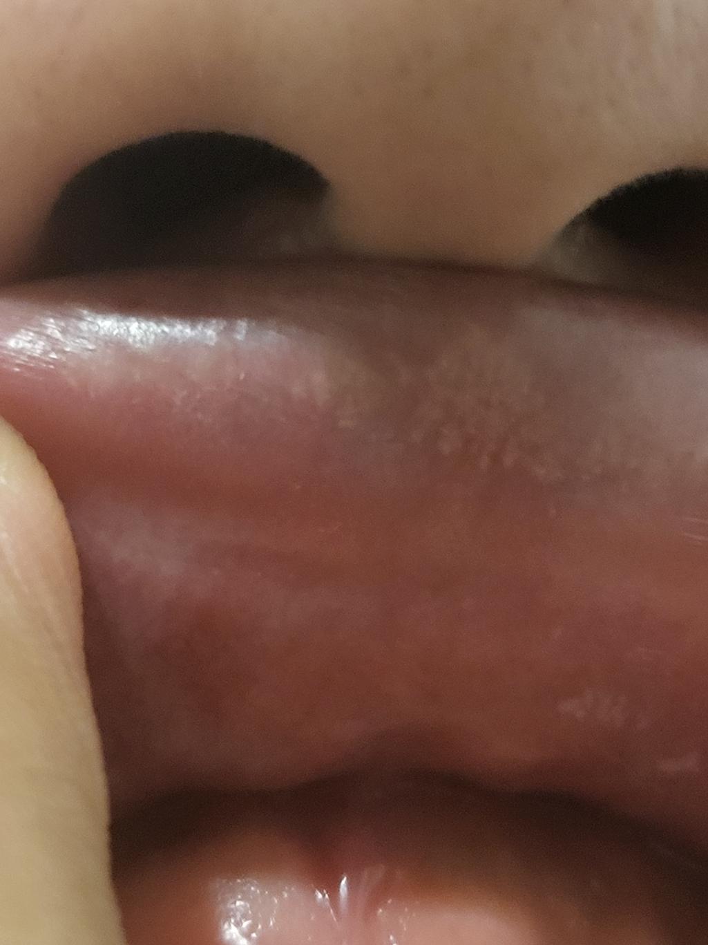 2번 째 사진
