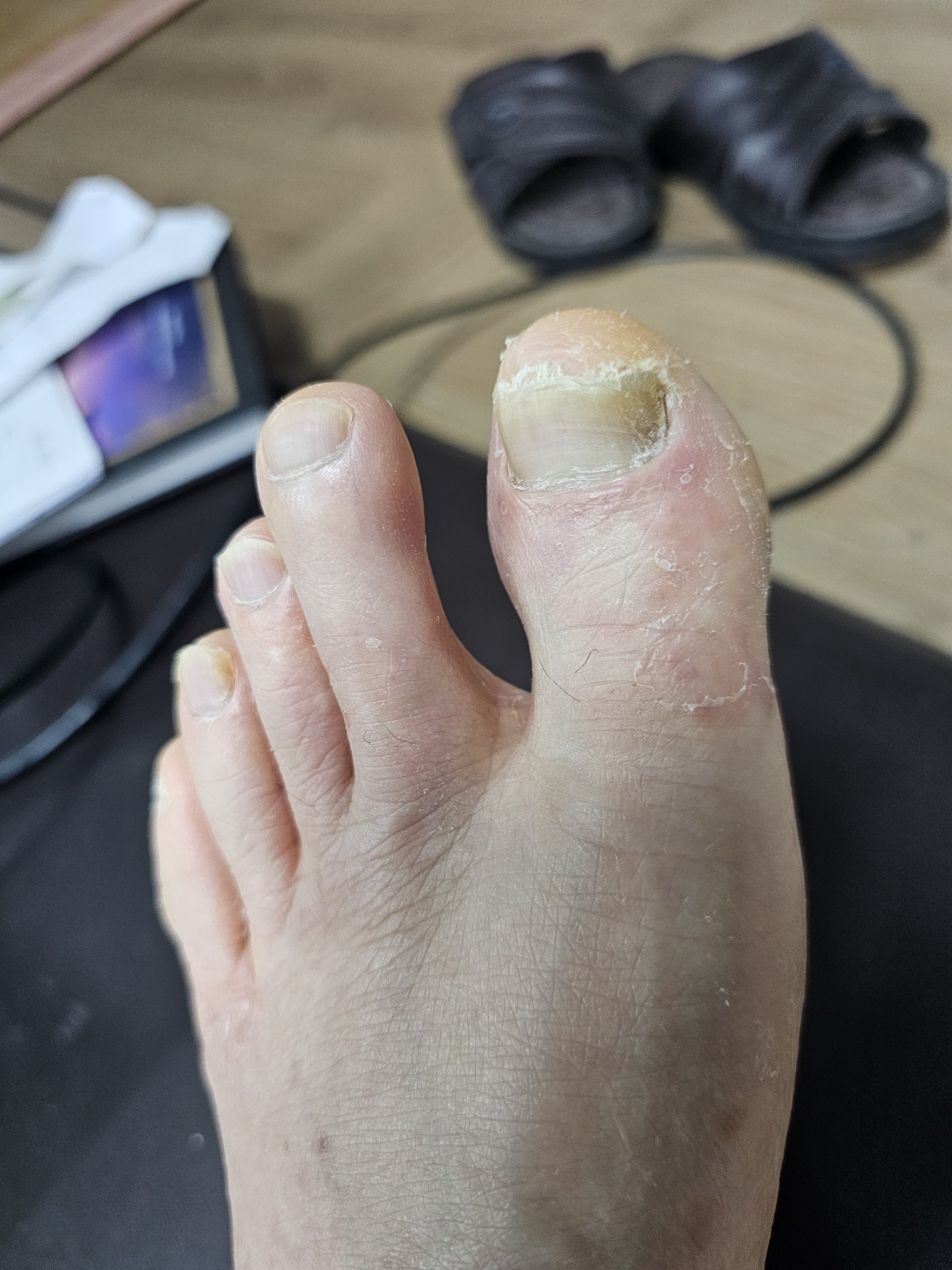 3번 째 사진
