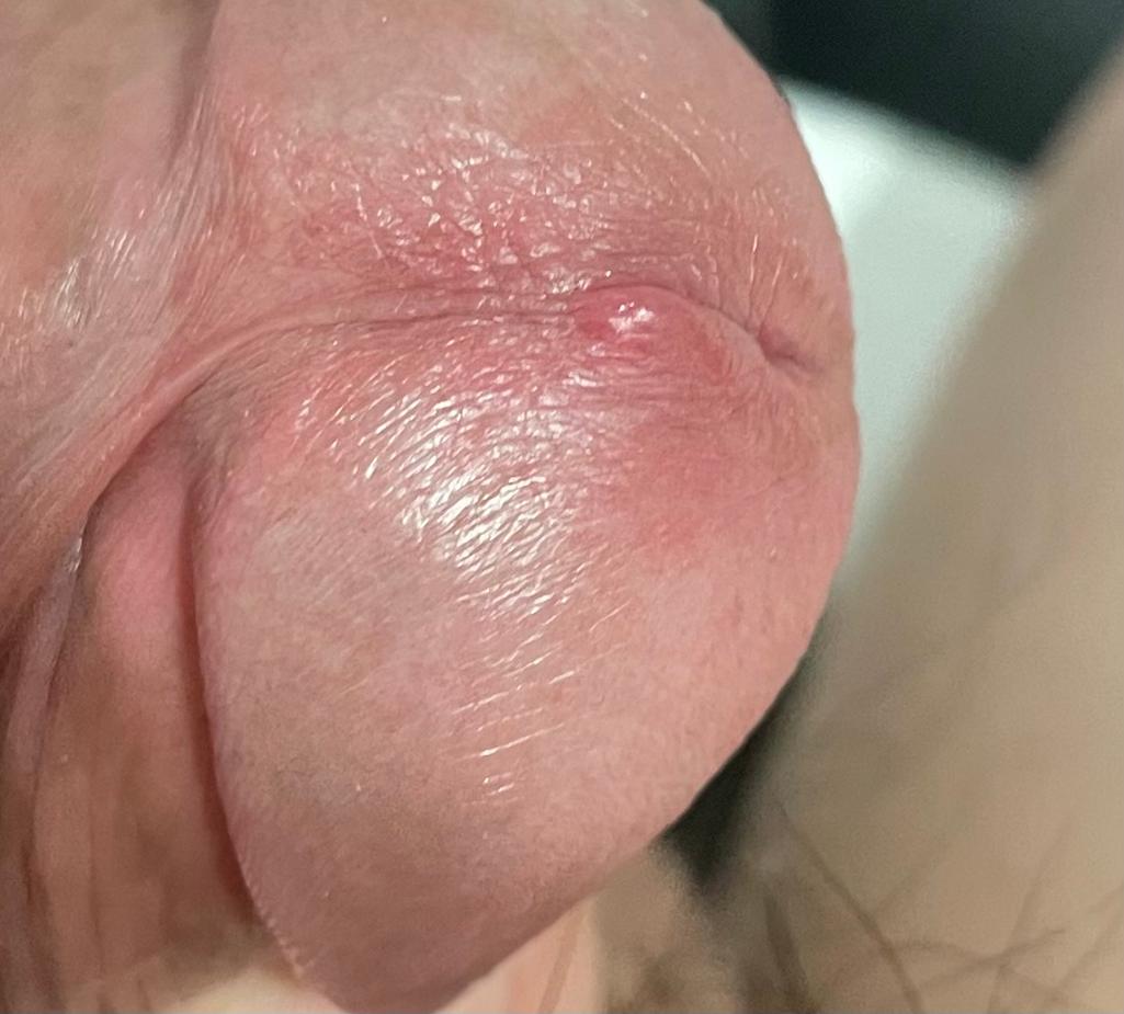 3번 째 사진