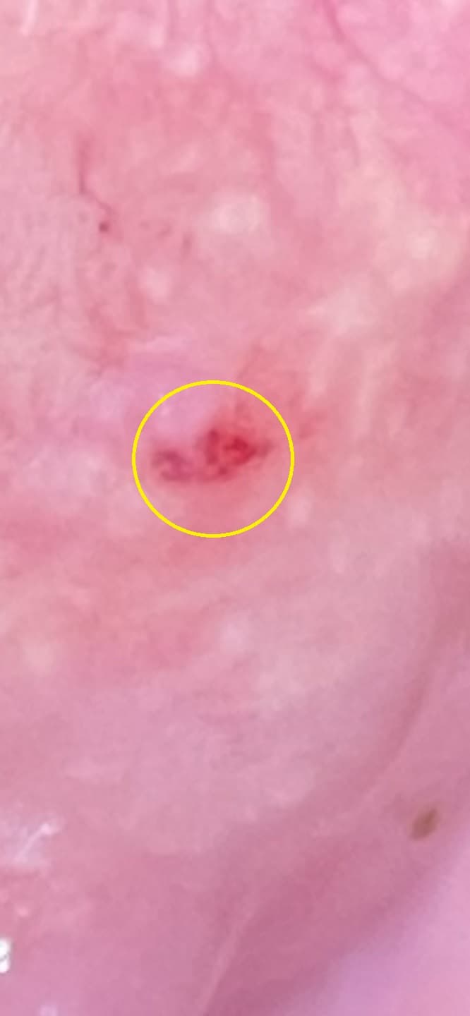1번 째 사진