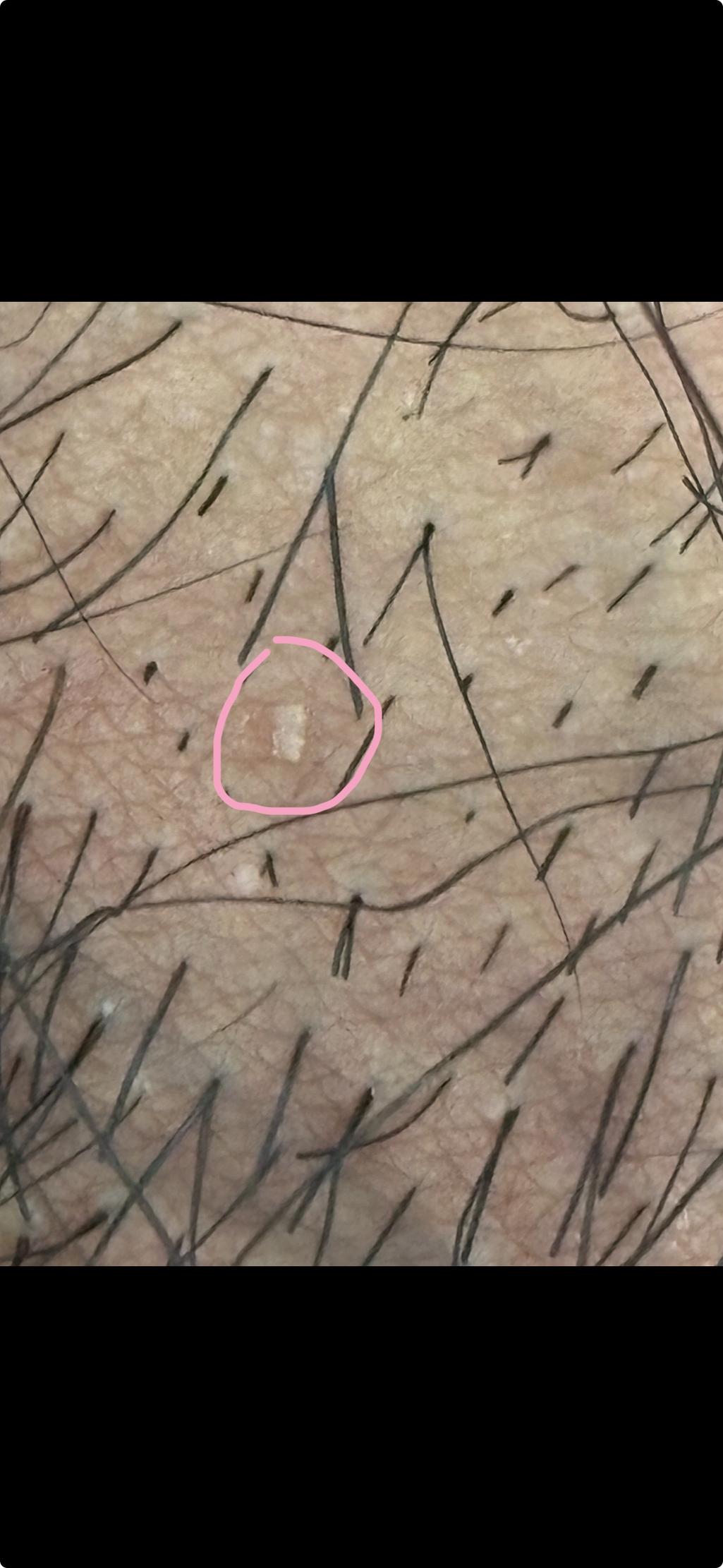 3번 째 사진
