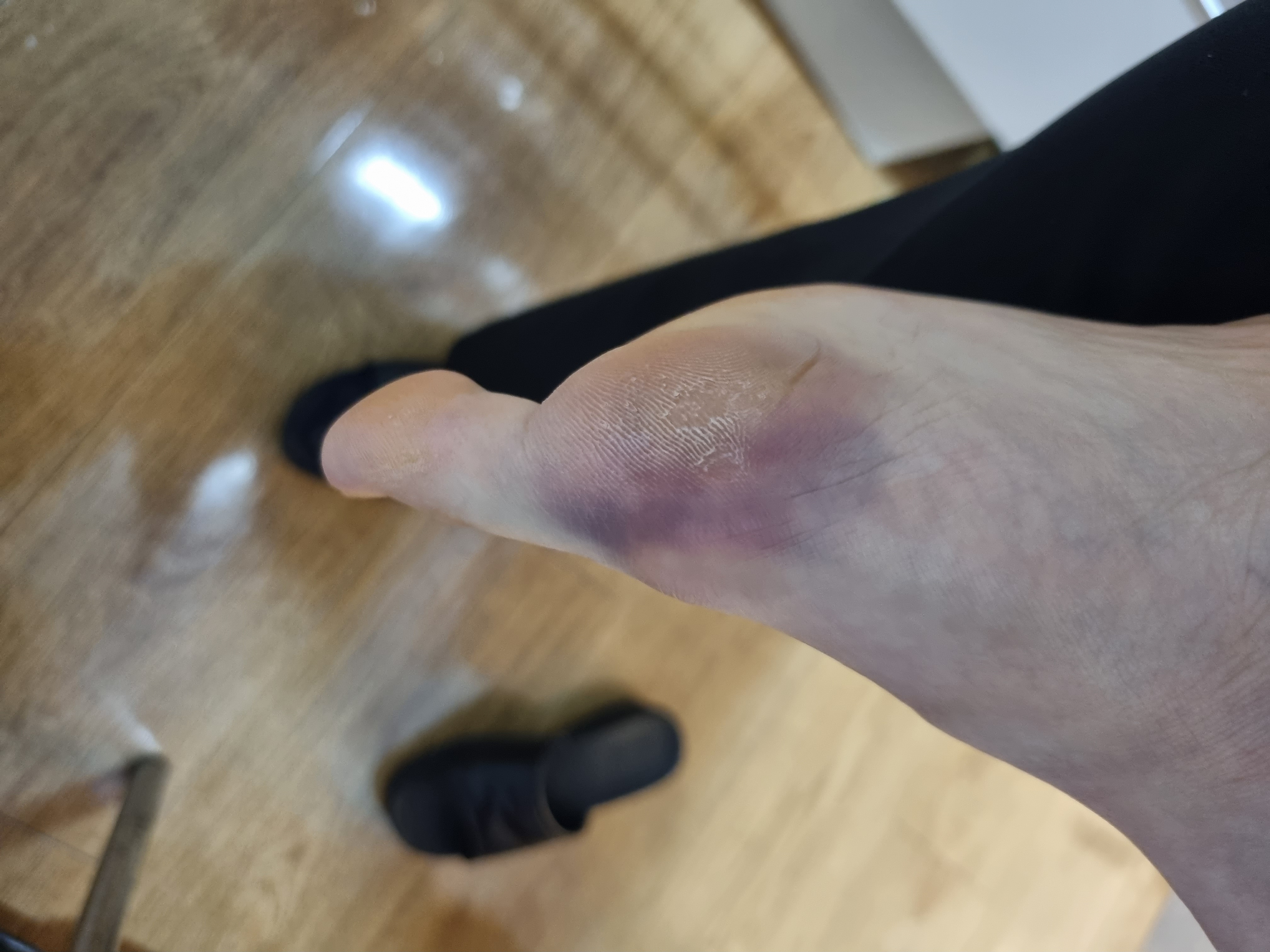2번 째 사진